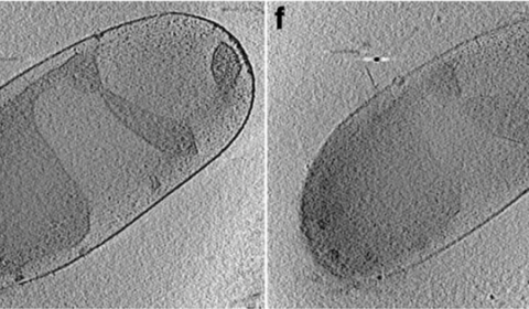 Ejemplos de la bacteria de interés en este estudio Planctopirus limnophila