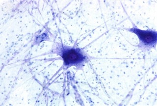 Neuronas