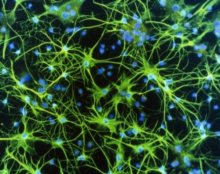 Micrografía de astrocitos. Fuente: NANCY KEDERSHA / SCIENCE PHOTO LIBRARY / Universal Images Group