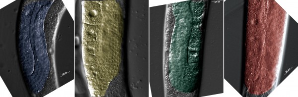 Malformaciones que sufre el nematodo modelo de galactosemia tipo III.En color se resaltan la morfología de las gónadas de diferentes individuos. Las tres primeras gónadas pertenecen a individuos modelo de esta enfermedad. Foto de la derecha gónada de un individuo normal. Nótese como en los individuos modelo de enfermedad las gónadas no cubren todo el diámetro del nematodo como ocurre en los individuos normales