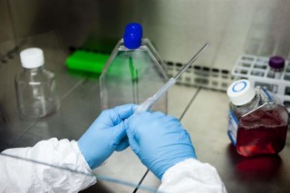 El planteamiento experimental y resultados del proyecto despiertan especial interés entre la comunidad científica y clínica.