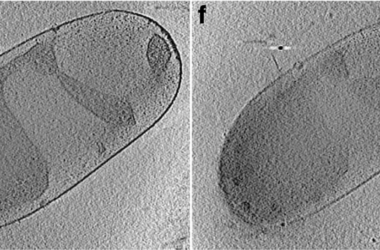 Ejemplos de la bacteria de interés en este estudio Planctopirus limnophila