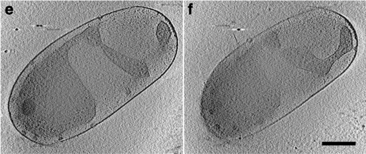 Ejemplos de la bacteria de interés en este estudio Planctopirus limnophila