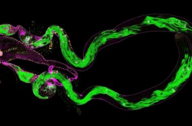 Formación de grupos de espermatozoides (verde) en testículos de una mosca de la fruta. (imagen tomada con microscopio)