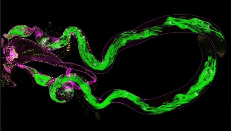 Formación de grupos de espermatozoides (verde) en testículos de una mosca de la fruta. (imagen tomada con microscopio)