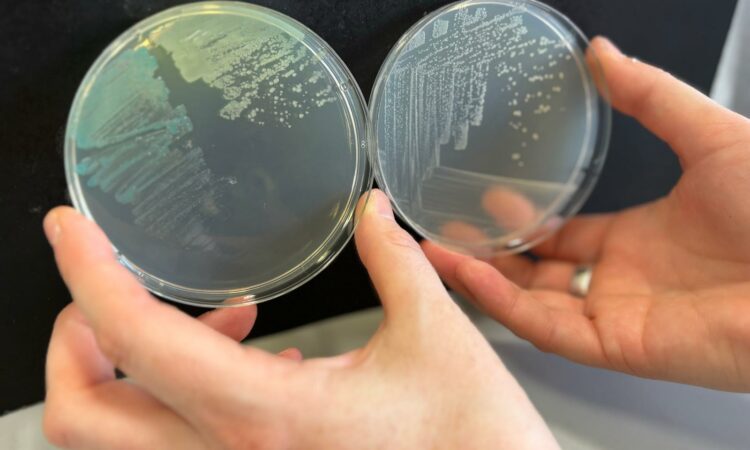 Placas con colonias de la bacteria Sphingopyxis granuli TFA utilizada en el estudio liderado por Francisca Reyes.