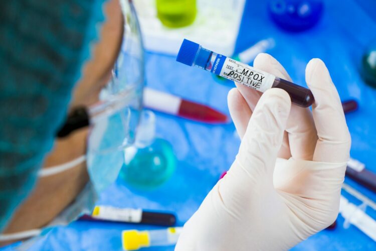 Análisis en laboratorio de una muestra de sangre