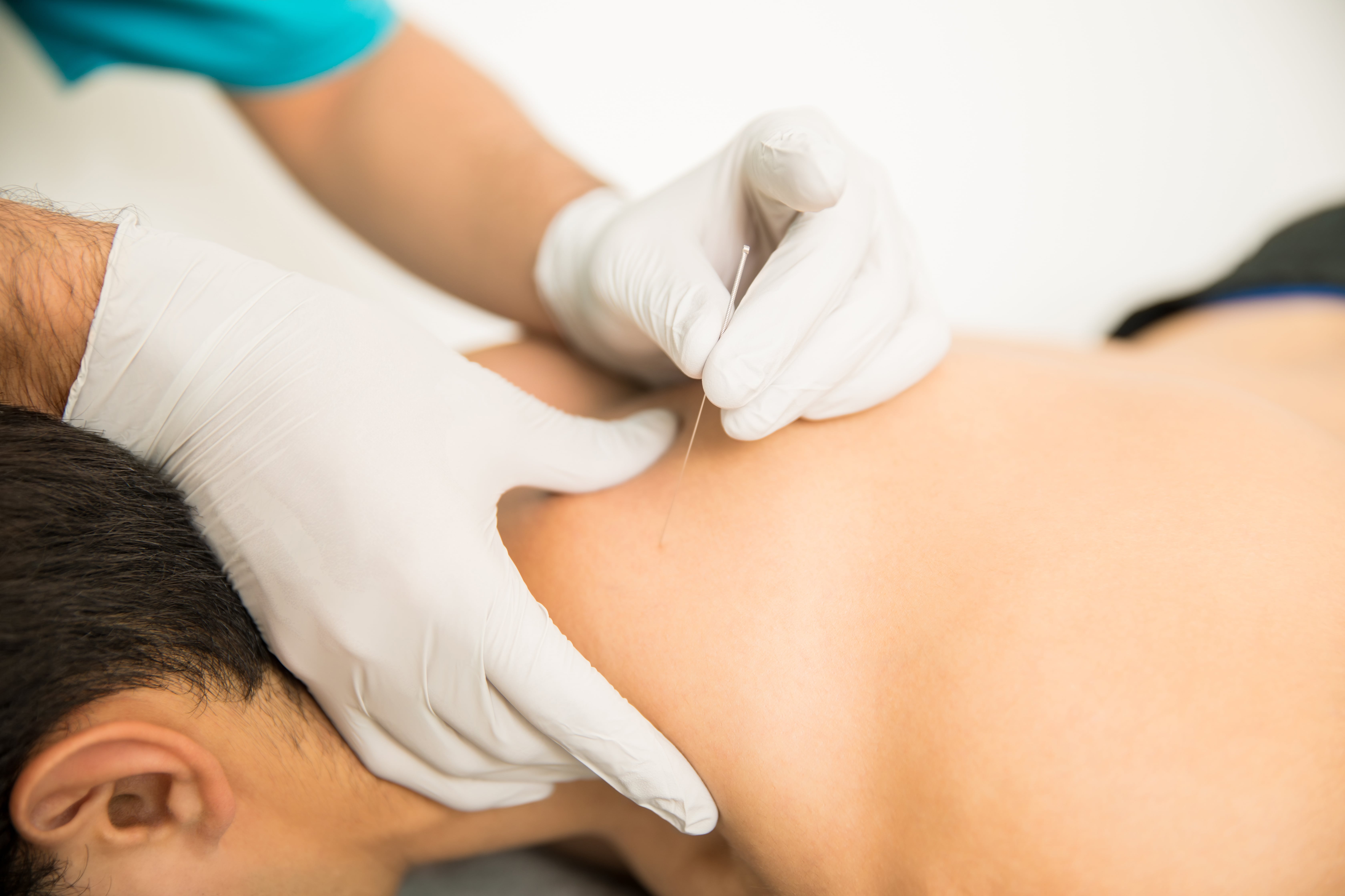 Máster en Neuroestimulación Percutánea y Acupuntura Médica