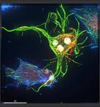 Apoptosis-UPO