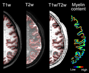 Myelin-content.png