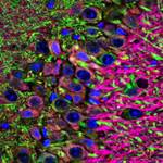 dos neuronas alzheimer