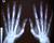 Radiografia-manos-sciencepics Radiografia-manos-sciencepics